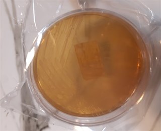 Staphylococcus aureus